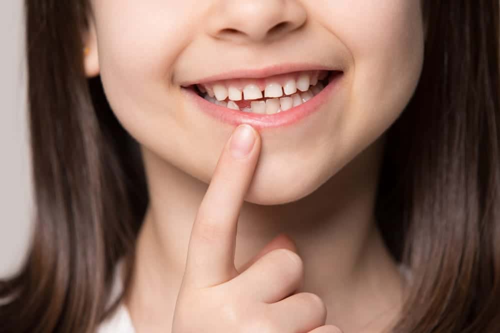 Close-up of little girl's smiling mouth, showing first permanent molar