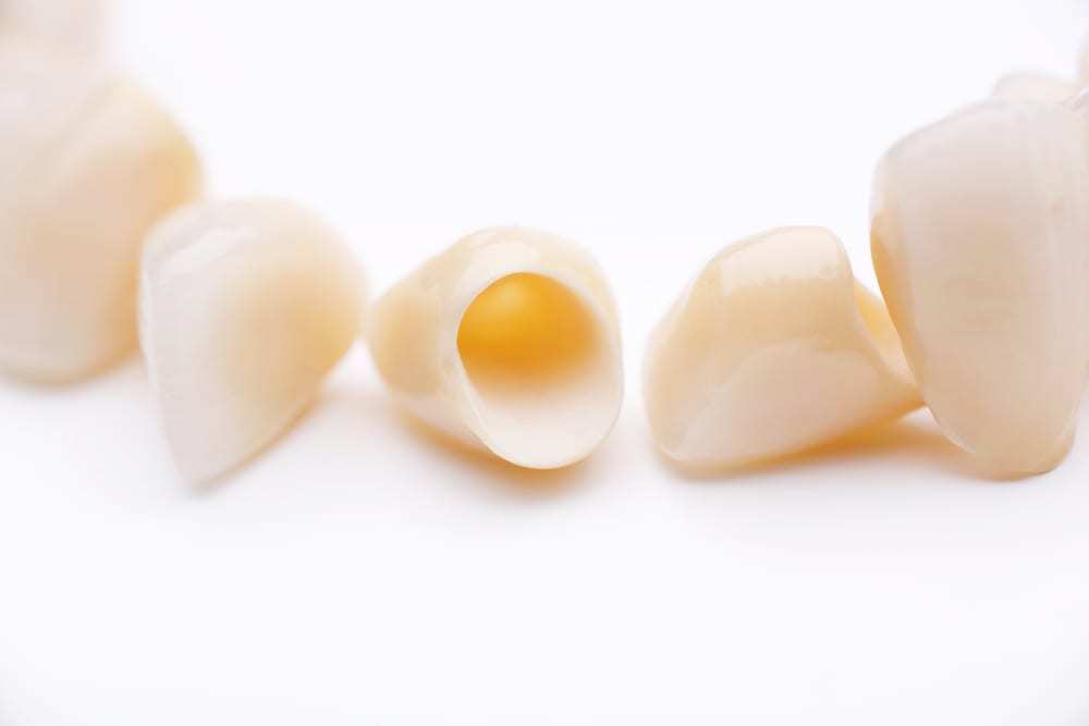 Close-up of several prosthetic teeth on white surface