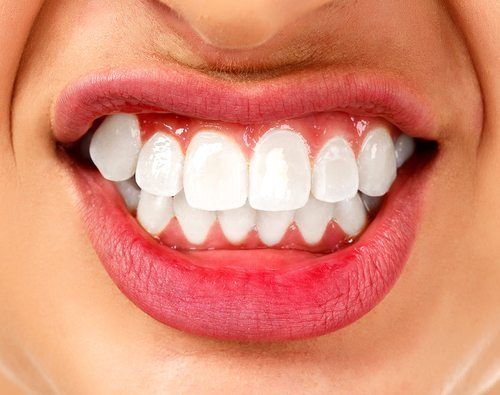 Teeth-Grinding Treatment