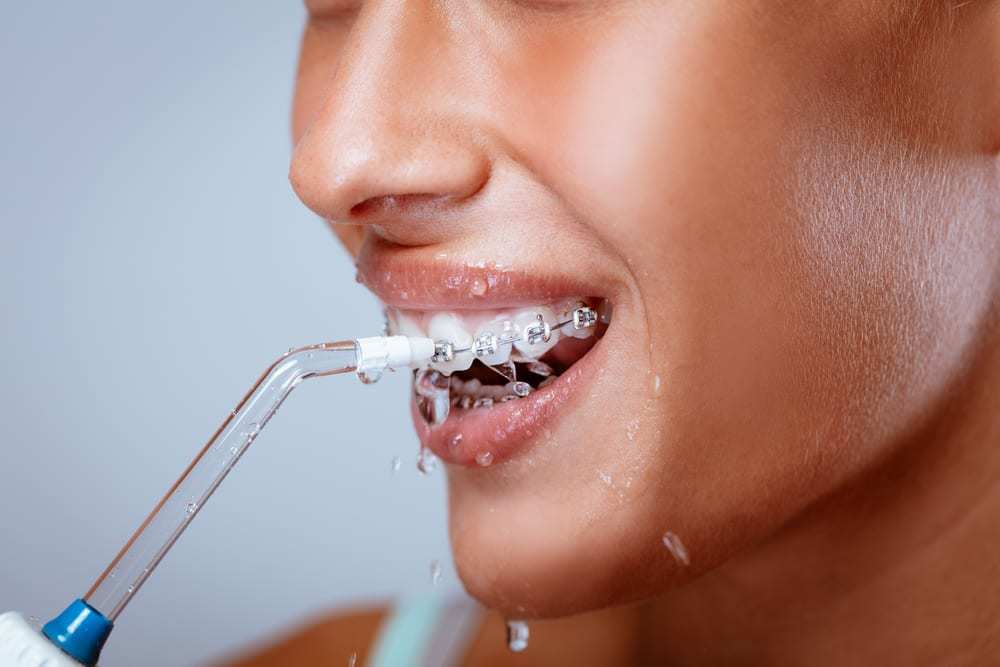 Young-woman-with-braces-using-a-waterpik-to-clean-her-teeth