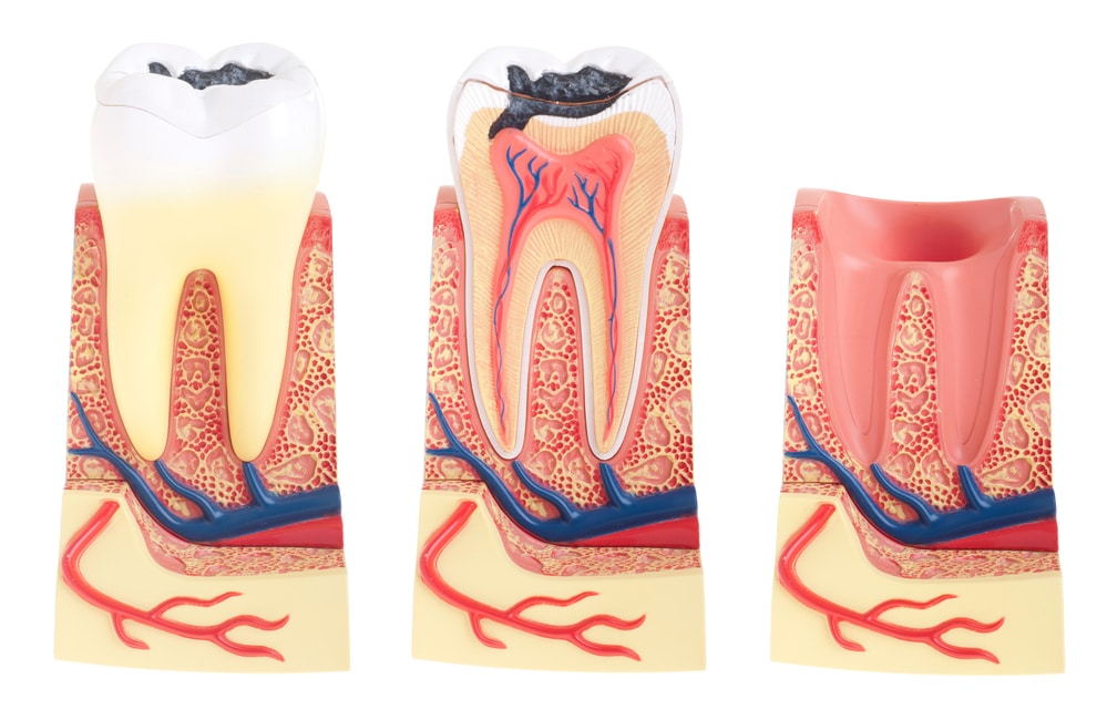 Tooth anatomy, three graphics, tooth in socket, tooth bisection, and empty socket