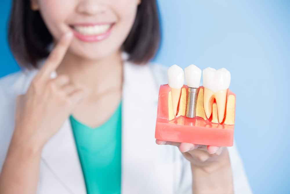 young smiling dentist holding plastic model of dental implant between two teeth