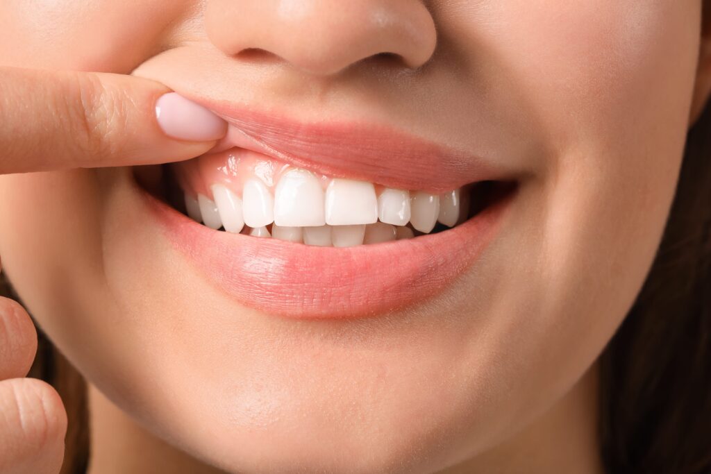 Close-up of young woman with healthy gums